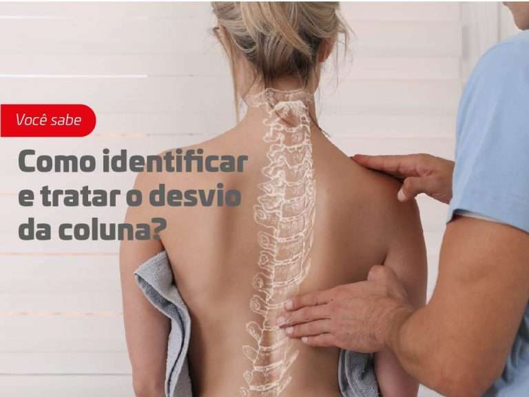 Como identificar e tratar o desvio da coluna?
