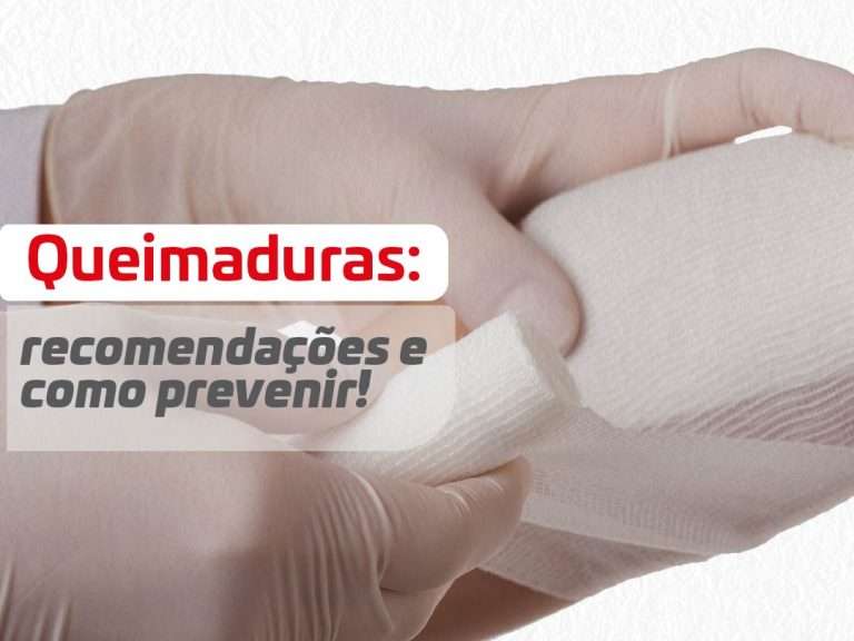 Queimaduras: recomendações e como prevenir