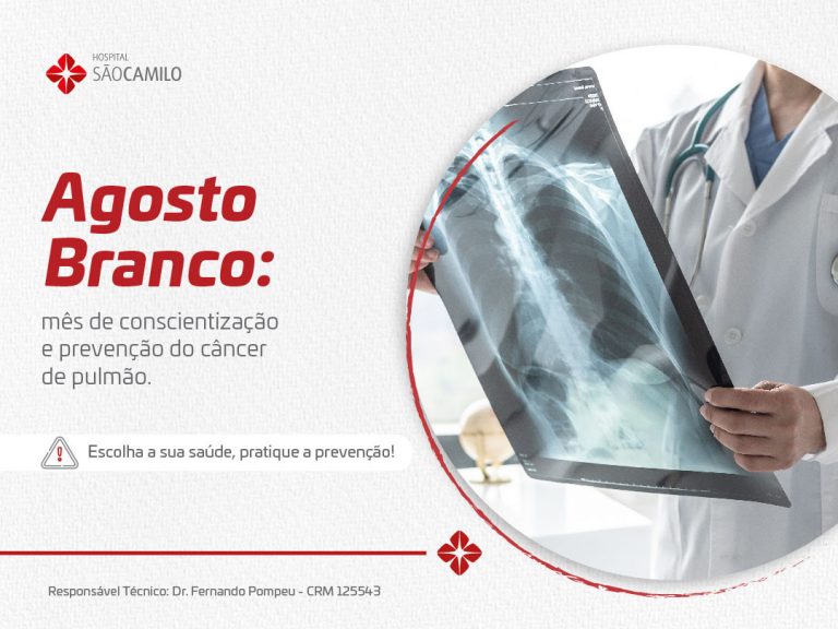 Agosto Branco: mês de conscientização e prevenção do câncer de pulmão