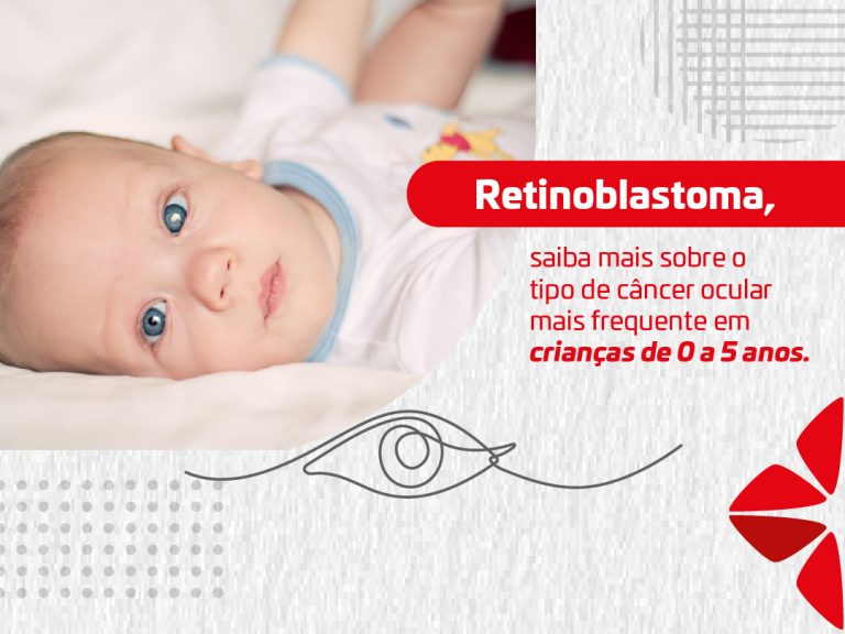 Retinoblastoma: saiba mais sobre o tipo de câncer ocular mais frequente em crianças de 0 a 5 anos