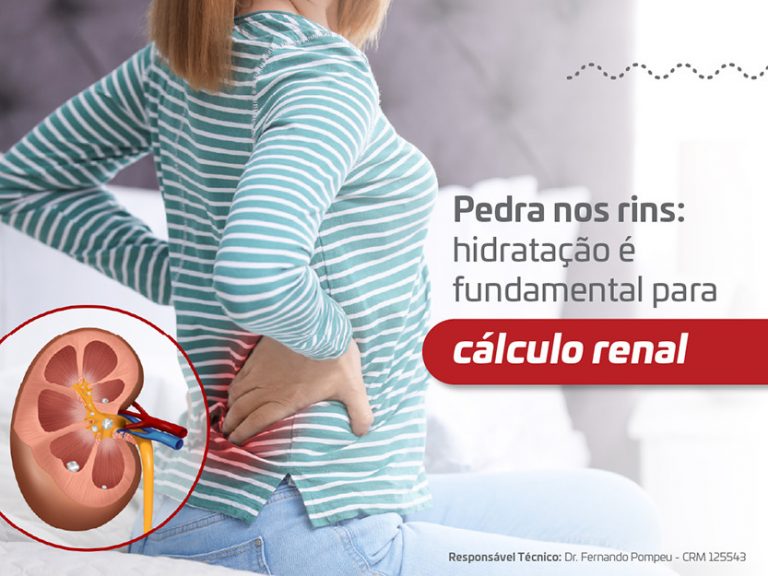 Pedra nos rins: hidratação é fundamental para evitar cálculo renal