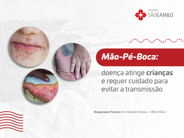 Mão-Pé-Boca: doença atinge crianças e requer cuidado para evitar a transmissão