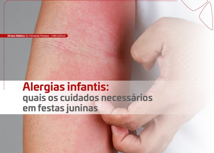 Release - Alergias e Festas Juninas_Banner