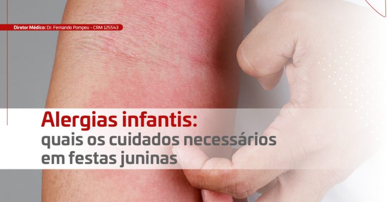 Release - Alergias e Festas Juninas_Banner