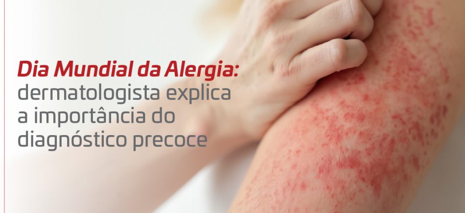 Release - Dia Mundial da Alergia_Banner