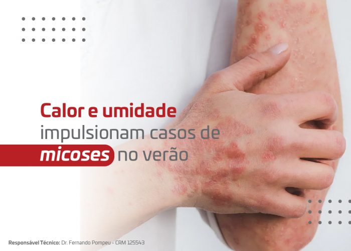 Release - Micose no verão_Banner