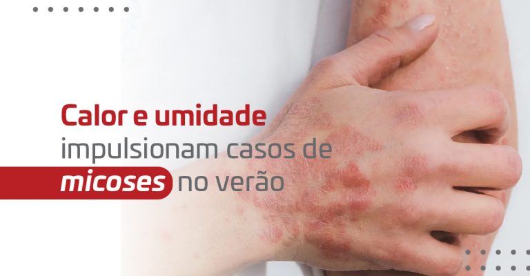 Release - Micose no verão_Banner