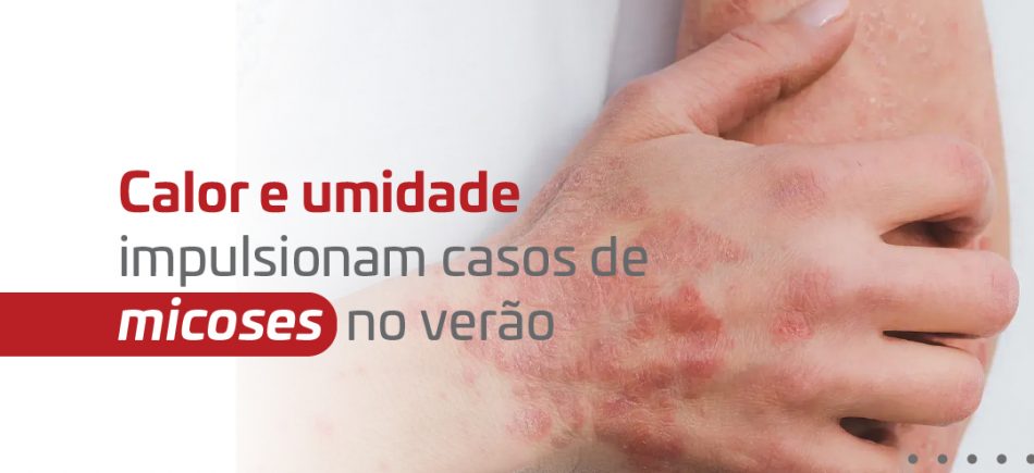 Release - Micose no verão_Banner