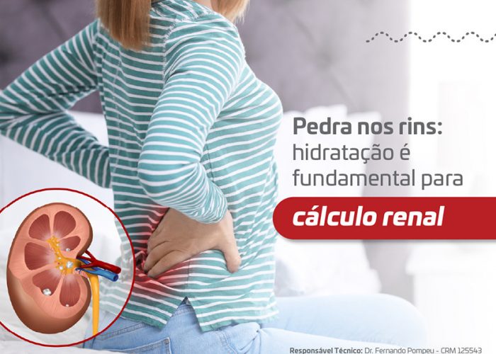 Release-Pedra-nosrins_Banner